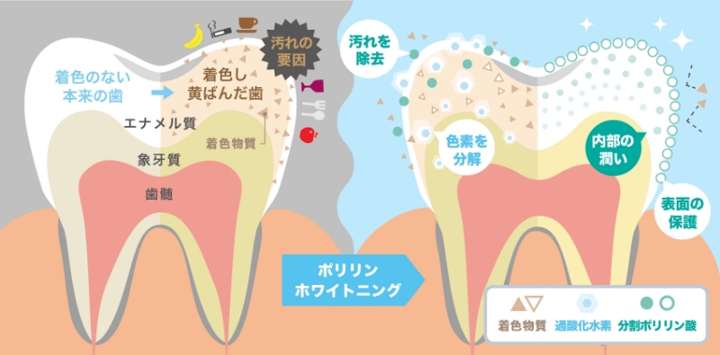 歯が白くなる仕組みの図